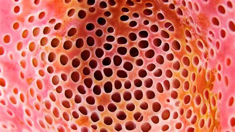 What Is Trypophobia And Is There A Cure Everyday Health Gotcha Stre