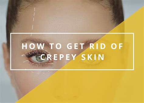How To Get Rid Of Crepey Skin How To Get Rid Of Crepey Skin