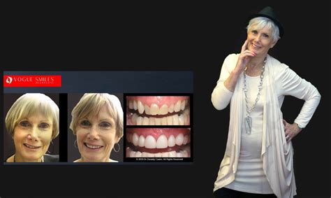 Cosmetic Dentistry Smile Makeovers Before And After Photos