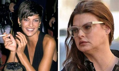 Linda Evangelista Poses For First Photoshoot Since Botched Surgery Left Her Deformed