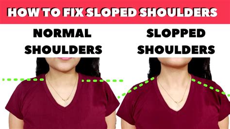 How To Fix Sloped Shoulders At Home Exercises Fix Bad Posture