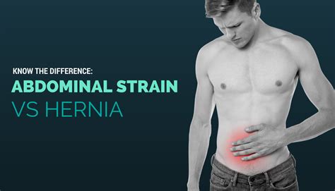 Inguinal Hernia Symptoms And Treatment Health Inputs The Best Porn Website