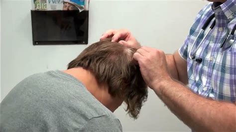 All Star Doctors Scalp Cyst Removal Youtube