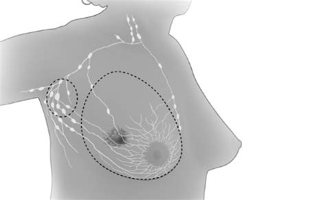 Top 7 Unconventional Signs Of Breast Cancer Morpheme Remedies India