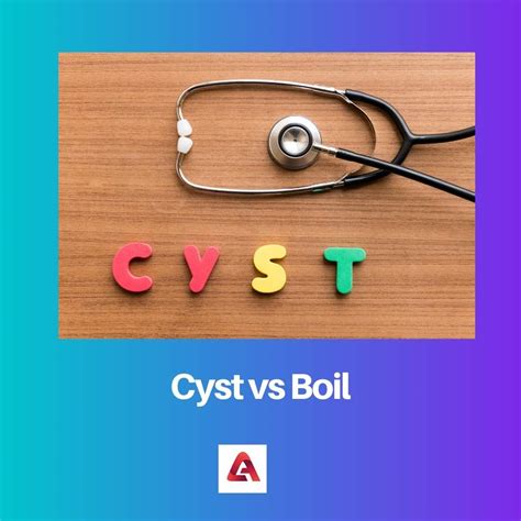 Cyst Vs Boil Difference And Comparison