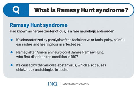 Syndrome De Ramsay Hunt Kieranleeanna