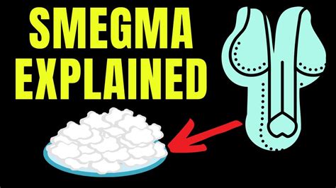 Doctor Explains Smegma Aka Build Up Of White Material Under The Penis