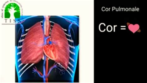 Cor Pulmonale Youtube