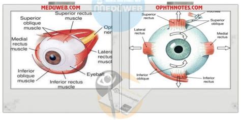 Clinical Notes On Eom Meduweb