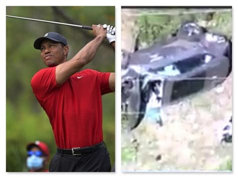 Updated Woods Suffers Multiple Leg Injuries In Lone Car Crash P M News