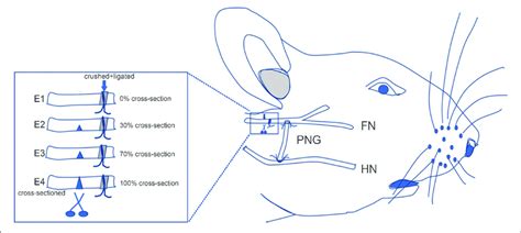 Schematic Showing The Surgical Procedures For Facial Nerve Fn