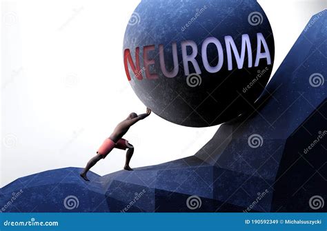 Neuroma As A Problem That Makes Life Harder Symbolized By A Person