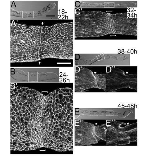 Cellular Morphogenesis Before Cuticle Formation The Tarsus Morphology
