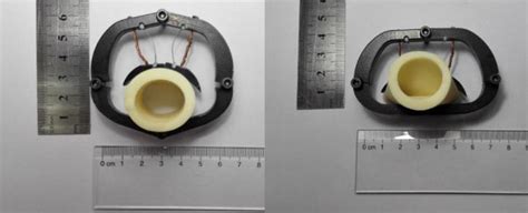assessment of a novel artificial anal sphincter with constant force ios press