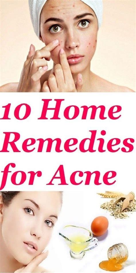 10 Home Remedies For Acne Beautytipsforblackwomen Acne Remedies