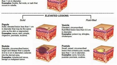 Dermatology Primary And Secondary Skin Lesions Youtube