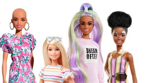 Mattel Introduces New Barbie Dolls With No Hair Skin Condition