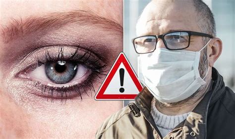 Coronavirus Warning Do Your Eyes Look Like This Hidden