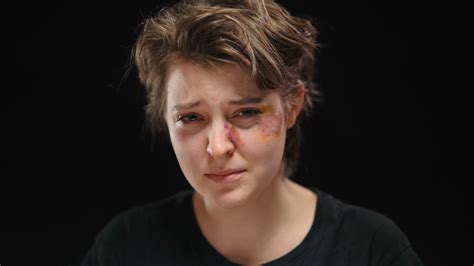 Close Up Beaten Face Of Abused Crying Young Woman Looking At Camera