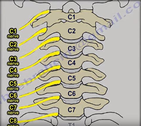 Cervical Radiculopathy Cervical Radiculopathy Is Caused By A By