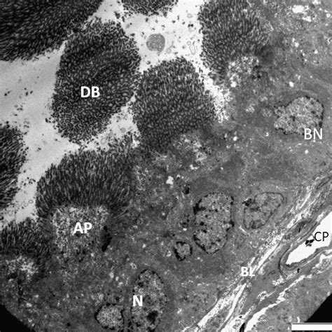 Electron Micrograph Of The Epithelium Of The Seminal Vesicular Gland Of