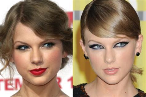 Taylor Swift Plastic Surgery Surgical Tech