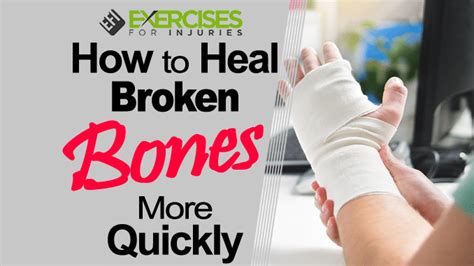 How To Heal Broken Bones More Quickly Artofit