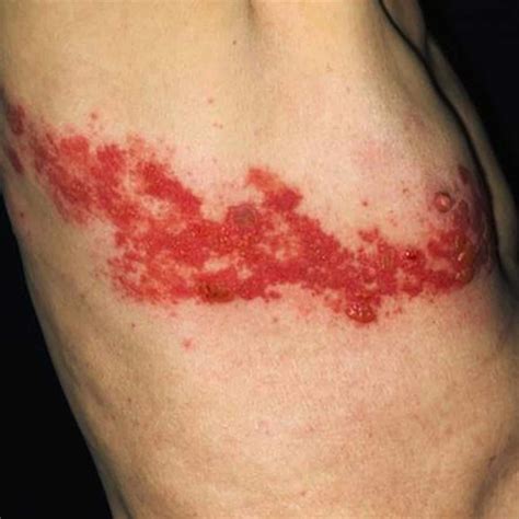 Common Skin Disease True Clinic