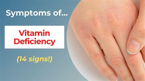 Top Symptoms Of Vitamin Deficiency Eating Enlightenment