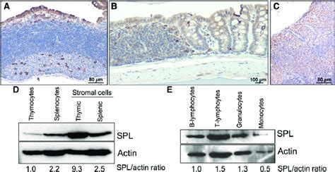 Spl Expression In Gut Associated Lymphoid Tissues Lymph Nodes And