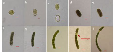 Dolichospermum Circinale Akinete Germination Scale Bar 10 µm