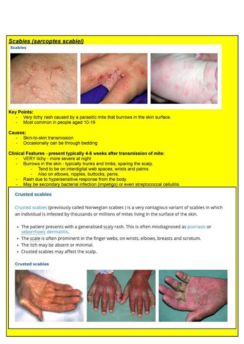 Scabies Lecture Notes Year Dermatology Scabies Sarcoptes Scabiei