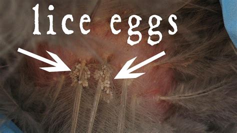 What Color Are Lice Eggs When They Are Alive Change Comin