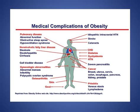 Breast cancer incidence in women with severe obesity or a body mass index (bmi) of 35 or higher was found to be 18 percent while incidence for closely the american society of clinical oncology (asco) calls obesity a major unrecognized risk factor for cancer that has also been associated with an. How to Lose Belly Fat