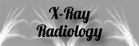 X Ray Radiology Department