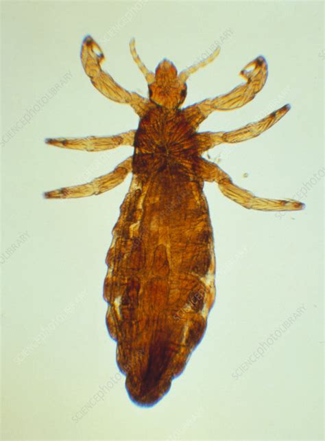 Lm Of Human Head Louse Stock Image Z2650021 Science Photo Library