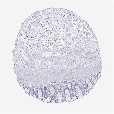 Tissue Expression Of PODXL Staining In Rectum The Human Protein Atlas