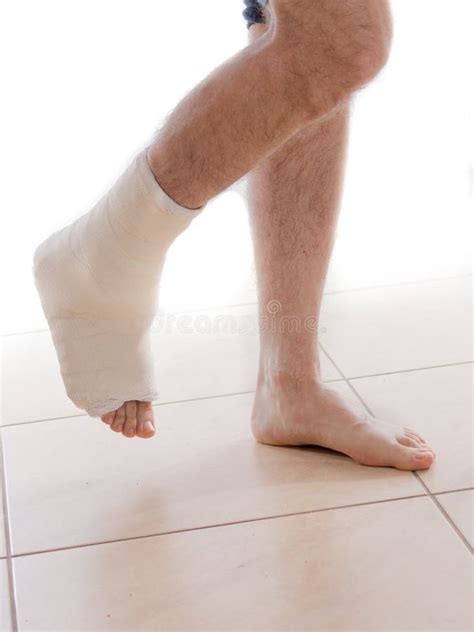 Young Man With A Broken Ankle And A Leg Cast Stock Photo Image Of