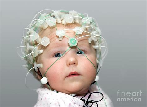 Baby Electroencephalography Photograph By Jon Wilsonscience Photo