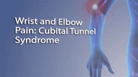 Cubital Tunnel Syndrome Faq With Dr Sophia Strike Youtube
