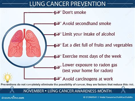 lung cancer prevention infographic vector illustration stock vector illustration of treatment