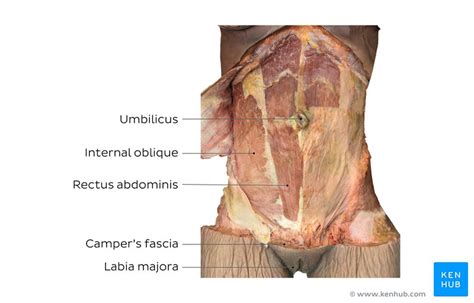 This medical exhibit features a single mid sagittal view of the female abdomen and pelvic anatomy fibrous adhesions are shown extending from the abdominal wall to the structures of the small intestines fallopian tube and the uterus other labels identify the strucutres of the umbilicus large bowel and the bladder adjacent to the adhesions. 32 Label The Muscles Of The Abdominal Wall - Labels ...