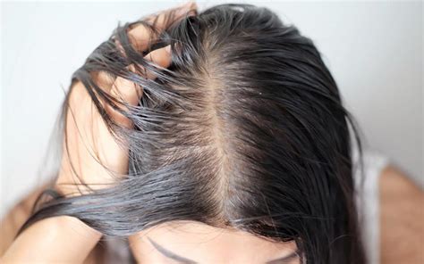 How To Get Rid Of Oil From Your Greasy Hair And Scalp Skinkraft