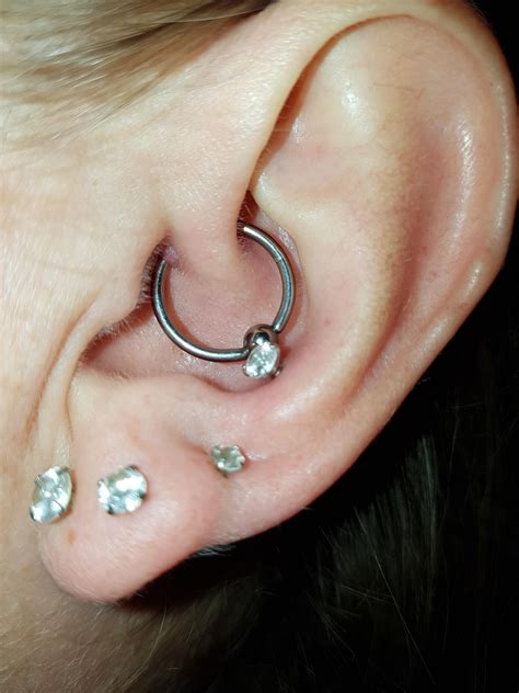 Daith piercing bump advice please. Details in the comments. : piercing