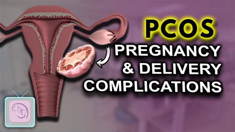 Pcos Signs Symptoms Causes Pregnancy Fertility And Pcos