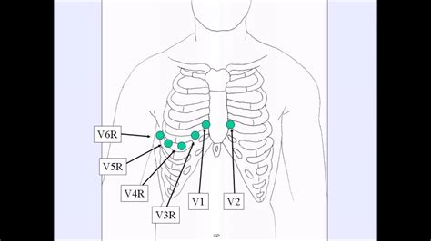 To get technical about it, your heart is located in your mediastinum (a membranous space located. How To: Complete Right Side ECG - YouTube