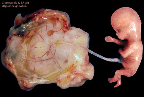 Les cellules nerveuses se multiplient considérablement, le squelette continue à se le foetus à 5 mois. Anatomie morphologique d'une grossesse de 12 SA - Images ...