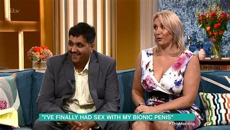 Sex Worker Who Helped A Man With A Bionic Penis Lose His Virginity