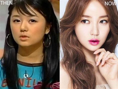 Has Yoon Eun Hye Underwent Plastic Surgery Let S Check Out Her Facial