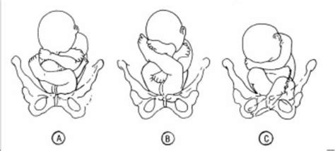 Fetal Positions And Adaptations